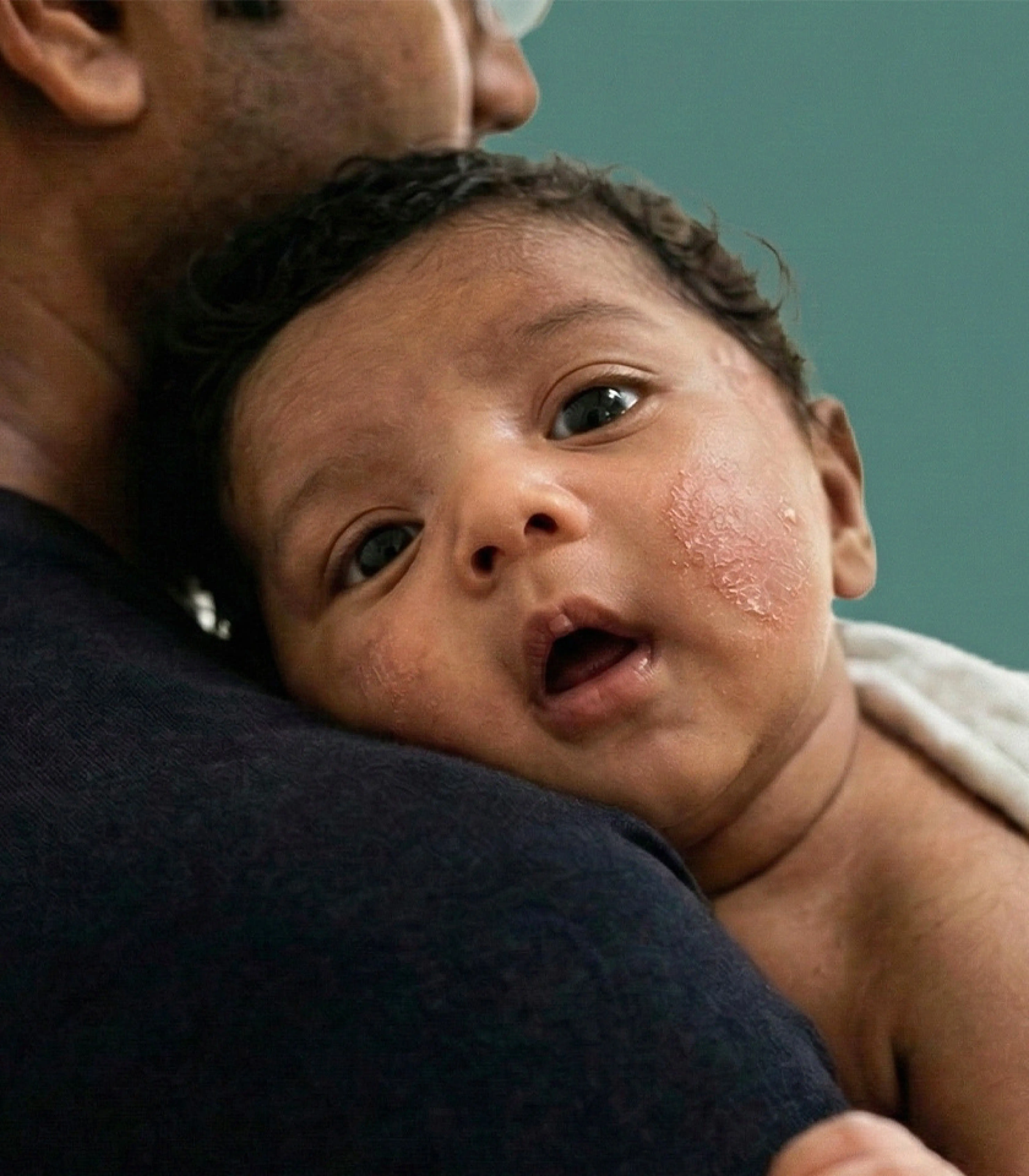 Children's skin care